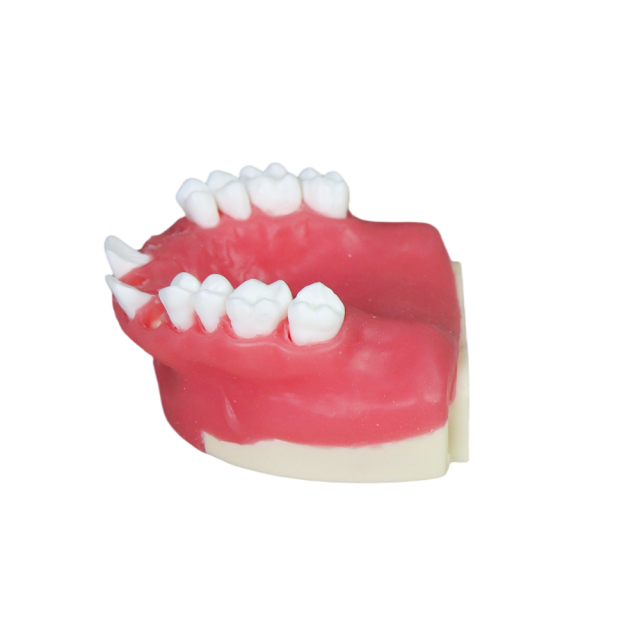 Dental Implant Training Model – Hard Resin with Soft Gum for Implant Practice JG-Y8-F2