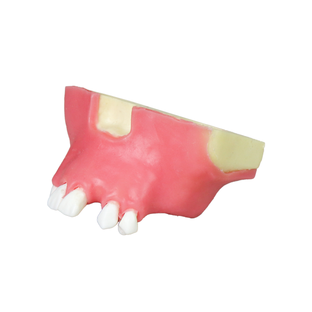 Sinus Lift Dental Model – Hard Resin with Soft Gums for Maxillary Sinus Training JG-Y11-S6