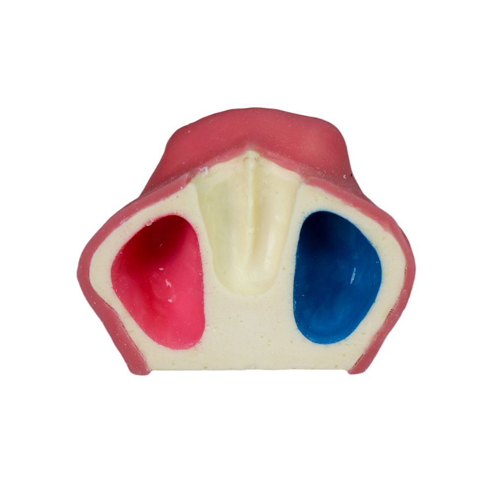 Sinus Lift Dental Model – Hard Resin with Soft Gums for Maxillary Sinus Training JG-YZ-11