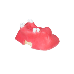 Sinus Lift Dental Model – Hard Resin with Soft Gums for Maxillary Sinus Training JG-Y11-S5