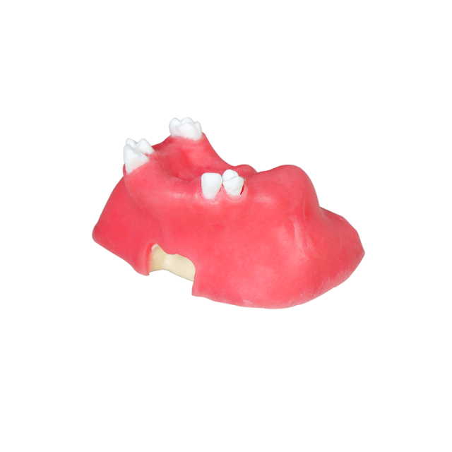 Sinus Lift Dental Model – Hard Resin with Soft Gums for Maxillary Sinus Training JG-Y11-S5