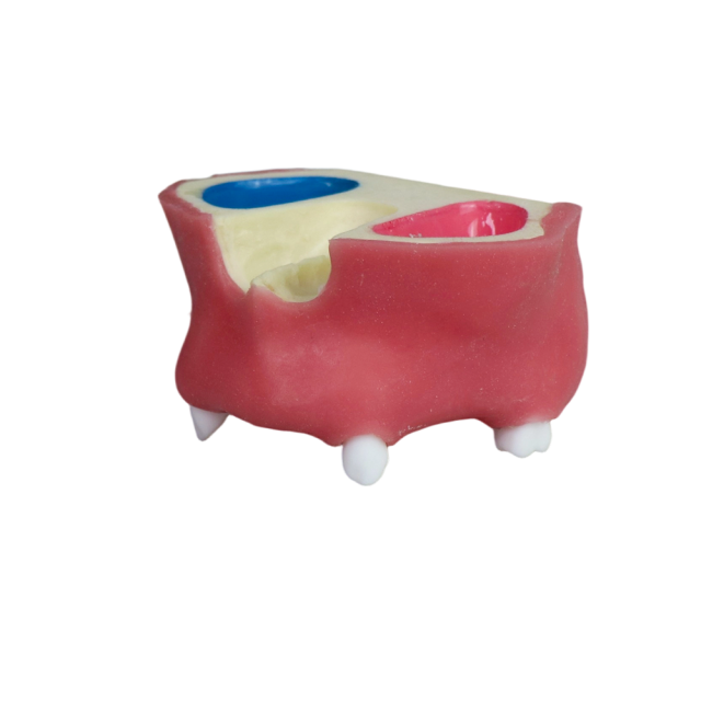 Sinus Lift Dental Model – Hard Resin with Soft Gums for Maxillary Sinus Training JG-YZ-11