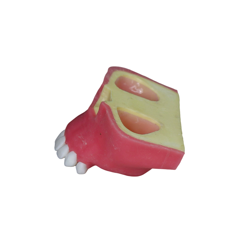 Sinus Lift Dental Model – Hard Resin with Soft Gums for Maxillary Sinus Training JG-Y27
