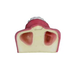 Sinus Lift Dental Model – Hard Resin with Soft Gums for Maxillary Sinus Training JG-Y27