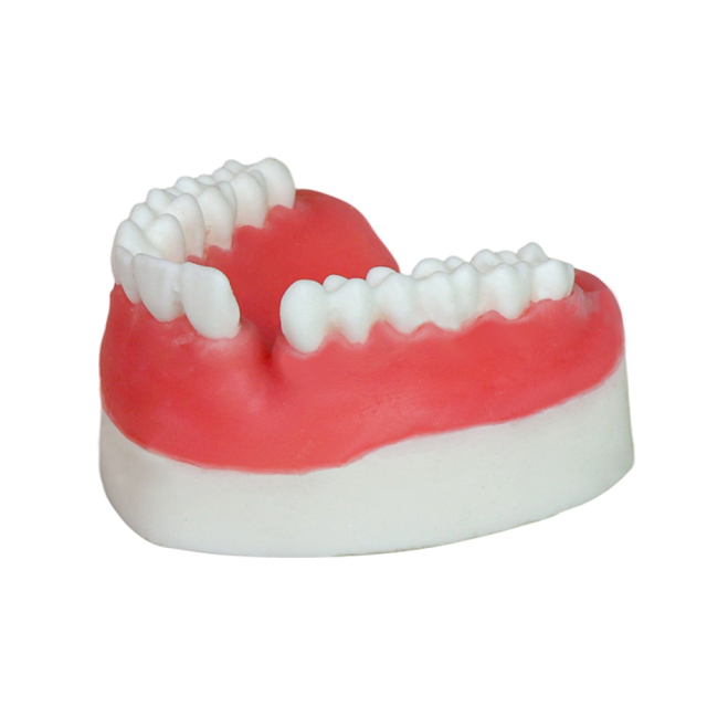 Cleft Lip and Palate Model JG-YC – Medical Demonstration for Patient Communication