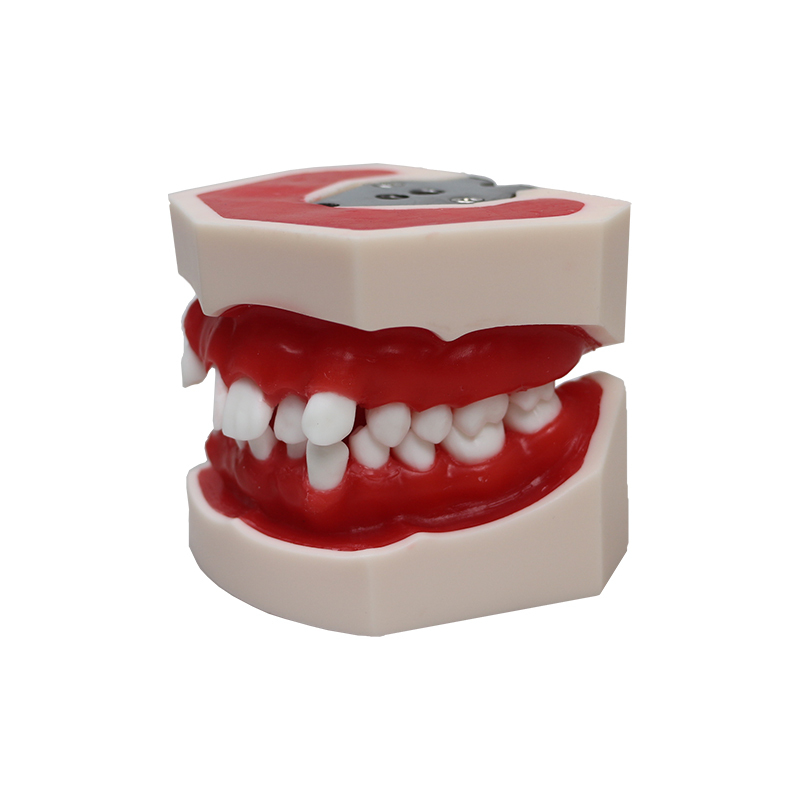 Orthodontic Wax Model | 28 Teeth Dental Training Model for Orthodontic Process Demonstration