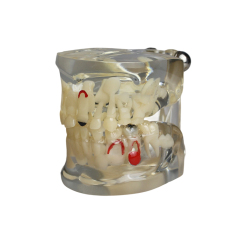 Transparent Deciduous and Permanent Teeth Replacement Model – Dental Teaching Aid