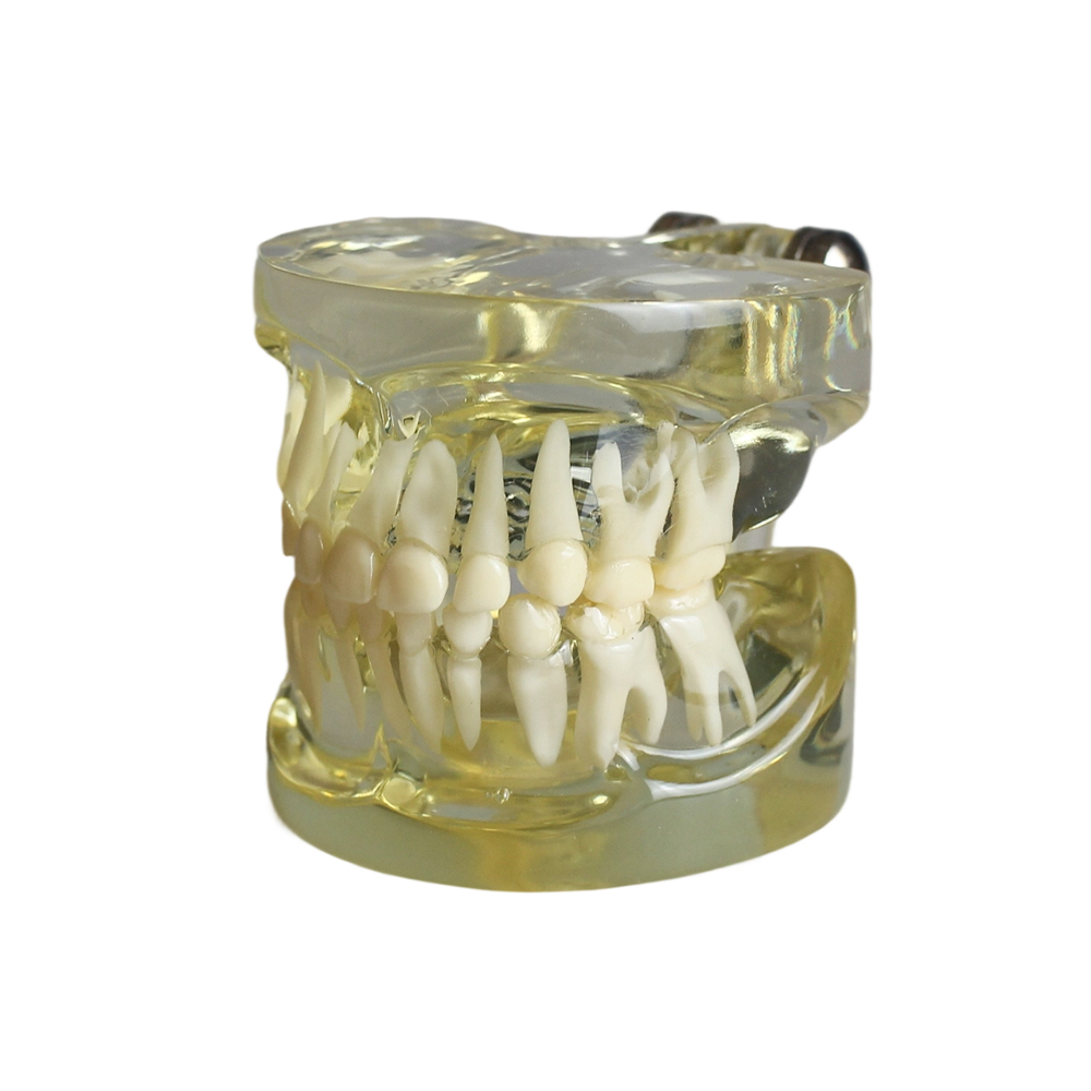 Transparent Standard Deciduous Teeth Model – Pediatric Dental Demonstration