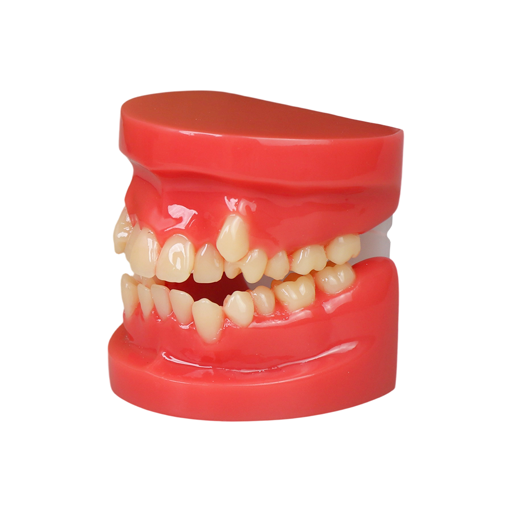 Orthodontic Demonstration Model