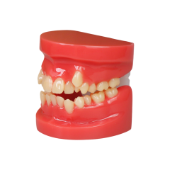 Orthodontic Demonstration Model