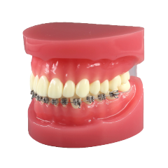 Orthodontic Demonstration Model JG-Y7-Y – 28 Teeth, Optional Brackets