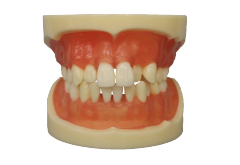 Tooth Extraction Model JG-Y9 – 28pcs with Extractable Teeth for Dental Training