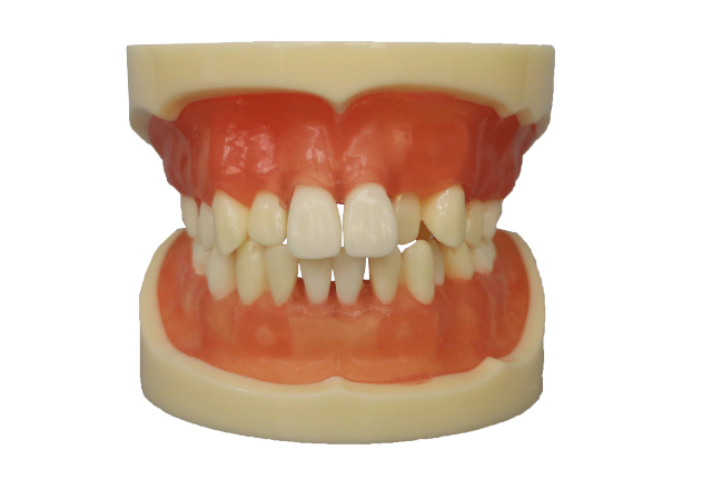 Tooth Extraction Model JG-Y9 – 28pcs with Extractable Teeth for Dental Training