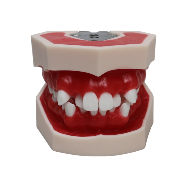 Orthodontic Wax Model | 28 Teeth Dental Training Model for Orthodontic Process Demonstration