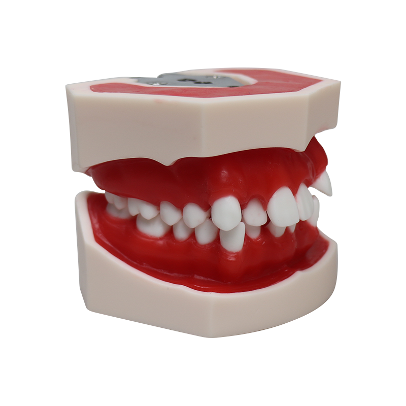 Orthodontic Wax Model | 28 Teeth Dental Training Model for Orthodontic Process Demonstration