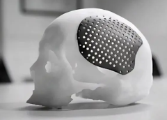 3D Printing Prototypes Medical Parts