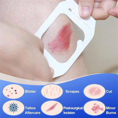 Transparent Film Dressing-Size 6 x 7 cm-Paper Frame Style- Waterproof breathable Wound care Adhesive Bandage