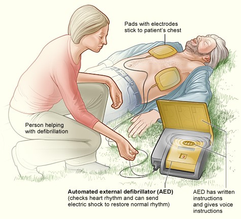How Do Defibrillators Work