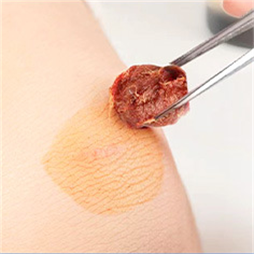 Medical Iodophor cotton balls-Easy to operate