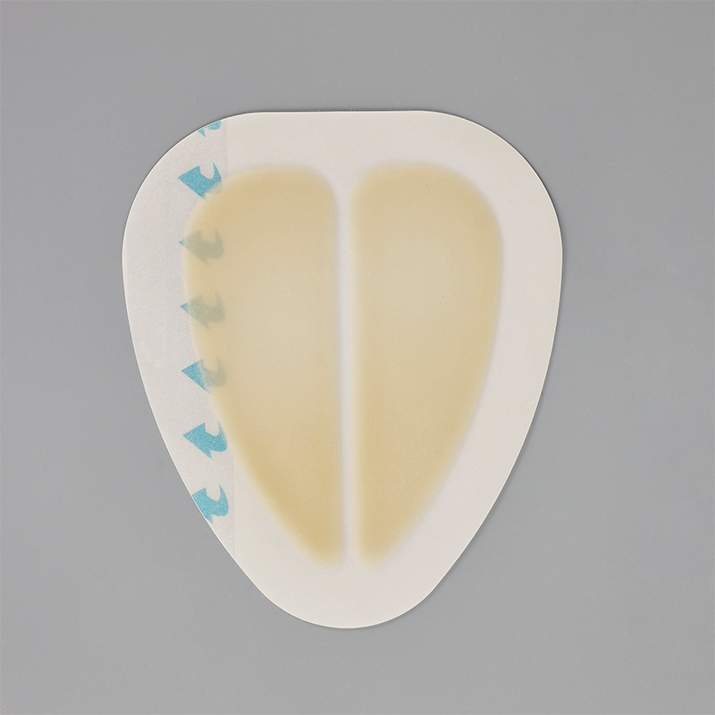 Sacral hydrocolloid dressing, size 15 cm x 18 cm, aesidhve bordered hydrocolloid bandage