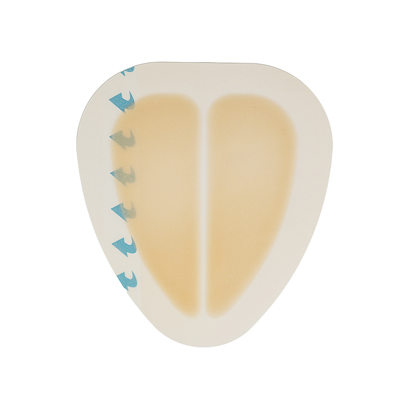 Sacral hydrocolloid dressing, size 15 cm x 18 cm, aesidhve bordered hydrocolloid bandage