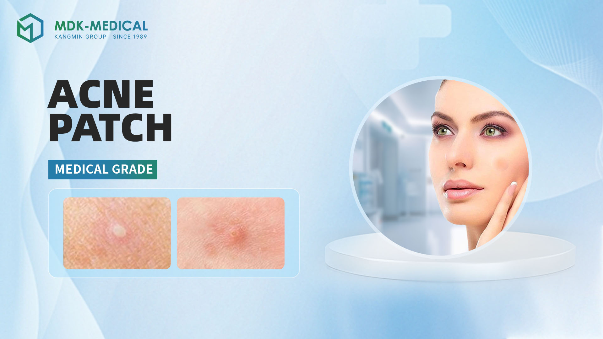 Understanding Acne and How MDK Medical’s Acne Patch Can Help