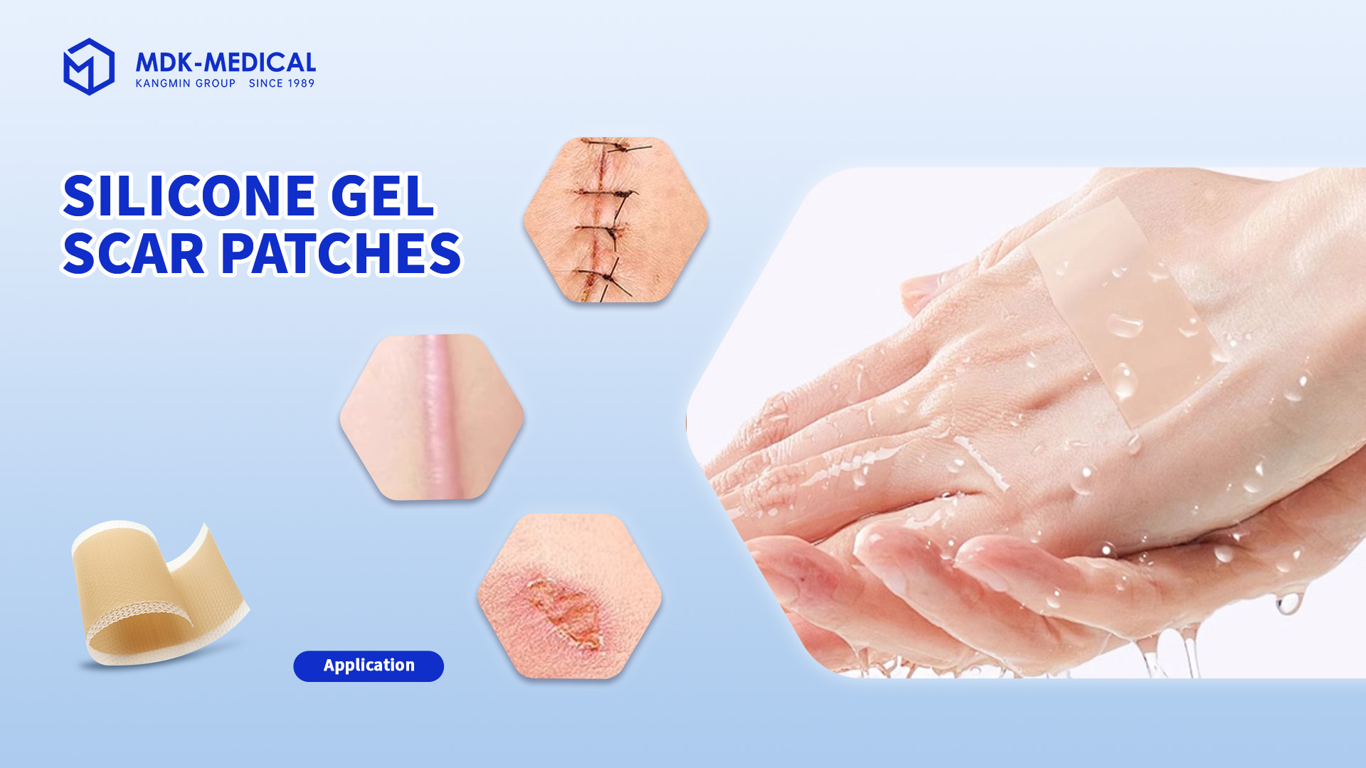 Unlock the Secret to Flawless Healing: Silicone Gel Scar Patches