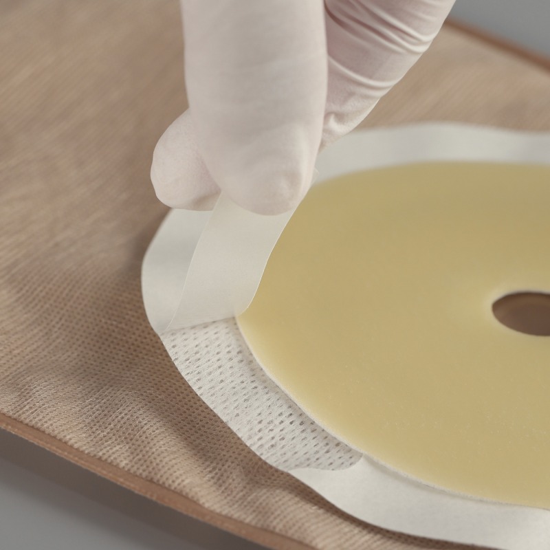 One-piece Drainable Ostomy Pouch -Double ring adhesive-PET backing-Secure and Comfortable Stoma Care