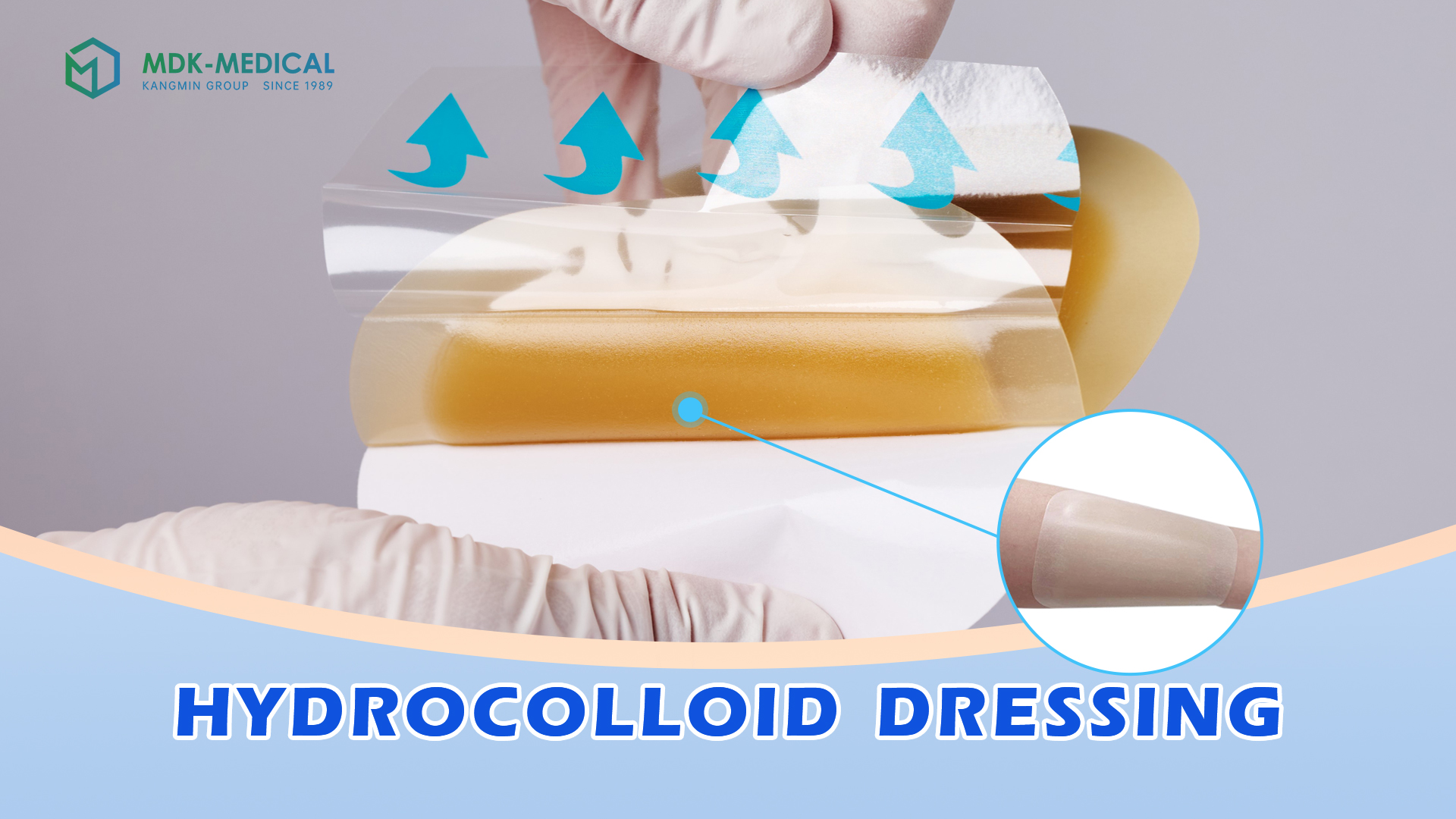 Why Hydrocolloid Dressings Are Essential in Modern Medical Supplies Management