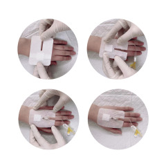 Non-woven I.V. dressing-Size 10 x 15 cm-Better air permeability and moisture absorption