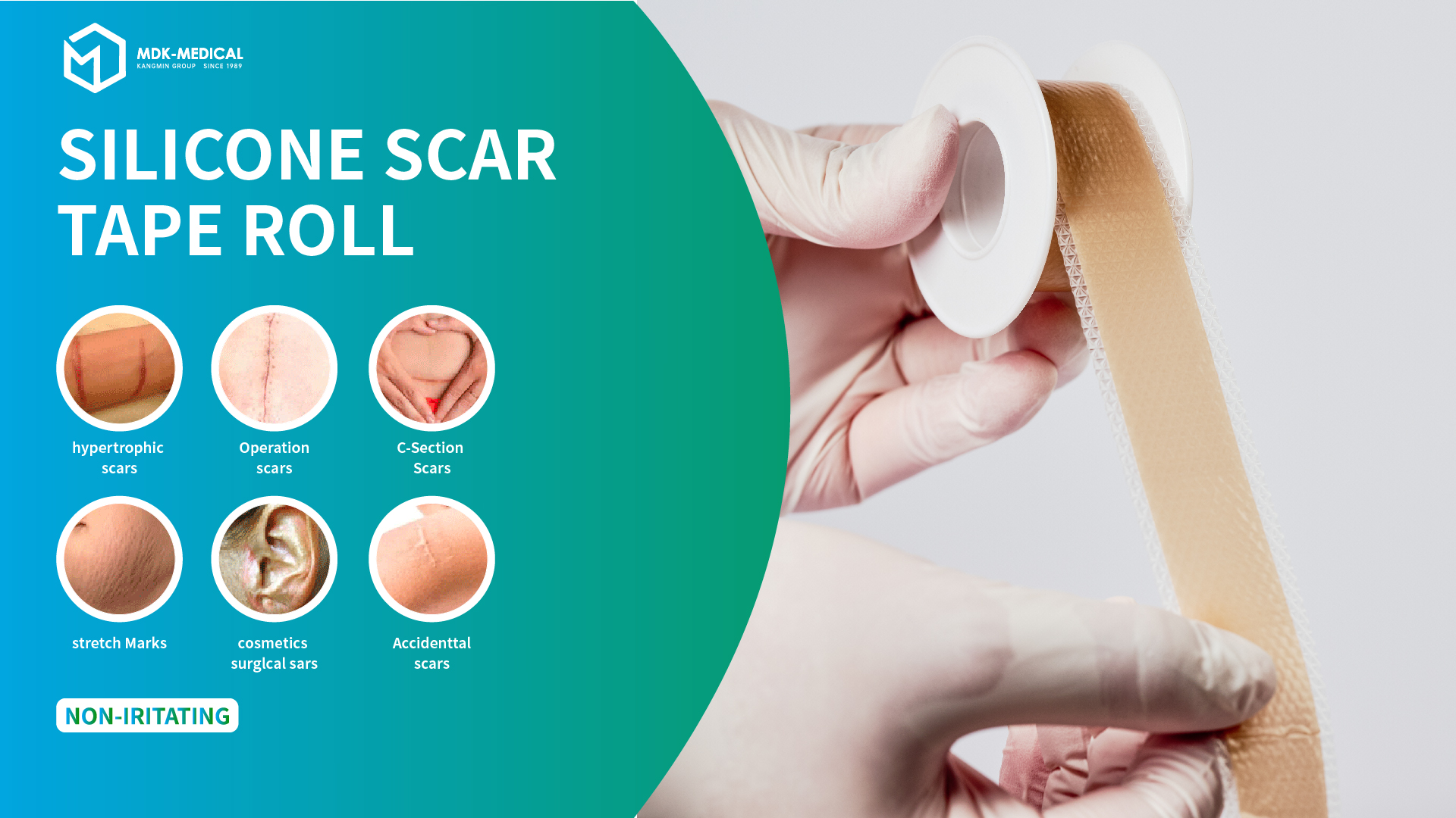 Optimizing Inventory: Smart Choices in Silicone-Based Medical Dressing