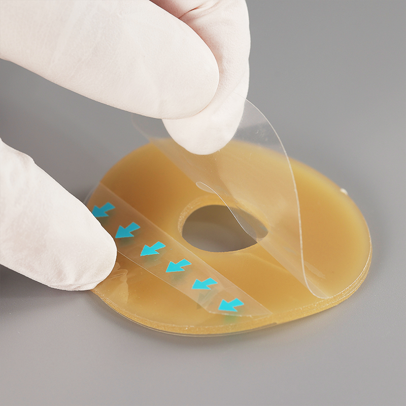 Ostomy Barrier Ring Ostomy Medical Supplies Barrier Ring-Adapt Barrier Rings Better Seal for Ostomy Bags-Stoma Rings,Outer