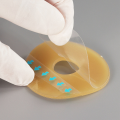 Ostomy Barrier Ring Ostomy Medical Supplies Barrier Ring-Adapt Barrier Rings Better Seal for Ostomy Bags-Stoma Rings,Outer