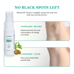 B17 Hair Removal Spray