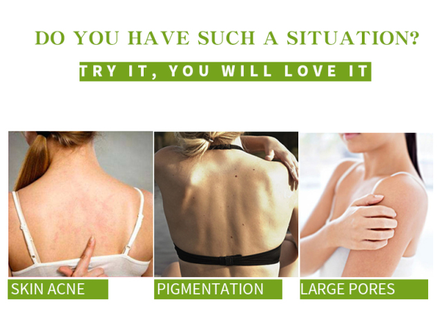 Matcha Green Tea Body Scrub