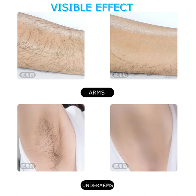 Hard Wax Beans for Body Hair Remove at Home