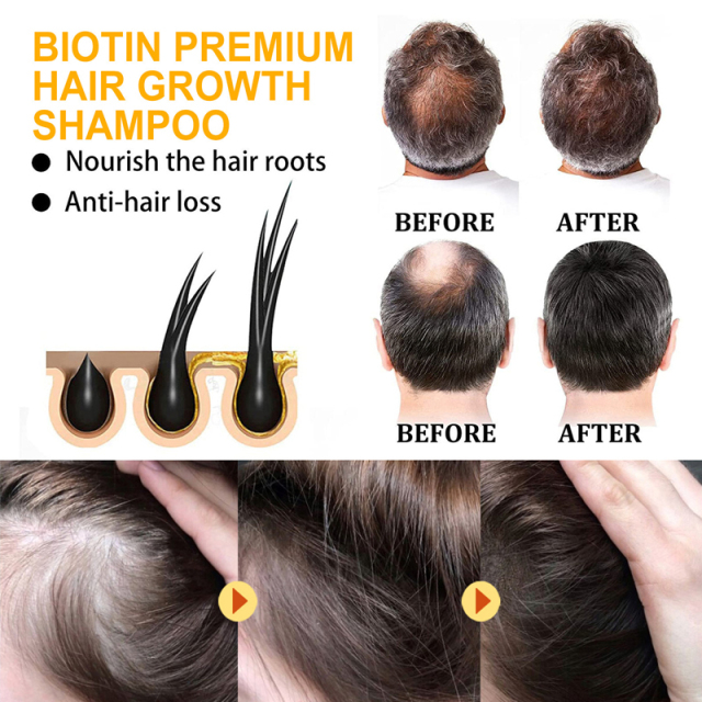 Biotin (B7) Hair Care Set