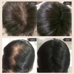 Anti-hair Loss Hair Wash Set