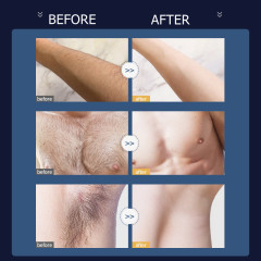 Men hair remove spray kit