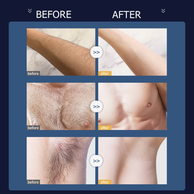 Men hair remove spray kit