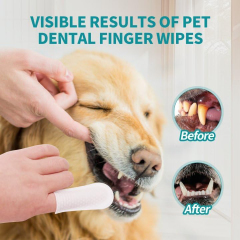 Pet Teeth Cleaning Finger Wipes