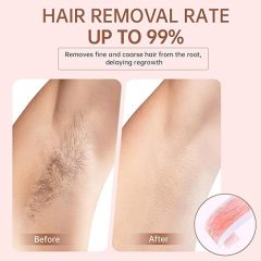 Hair Removal Wax Roller Refill