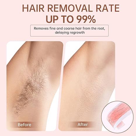 Hair Removal Wax Roller Refill