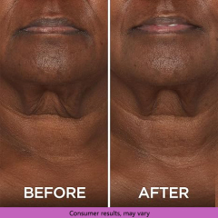 Tighten & Lift Neck Cream
