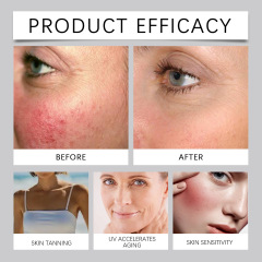 Hyaluronic Acid Skin Cream