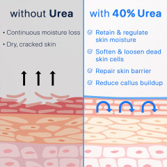 Urea Foot Cream
