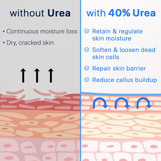 Urea Foot Cream
