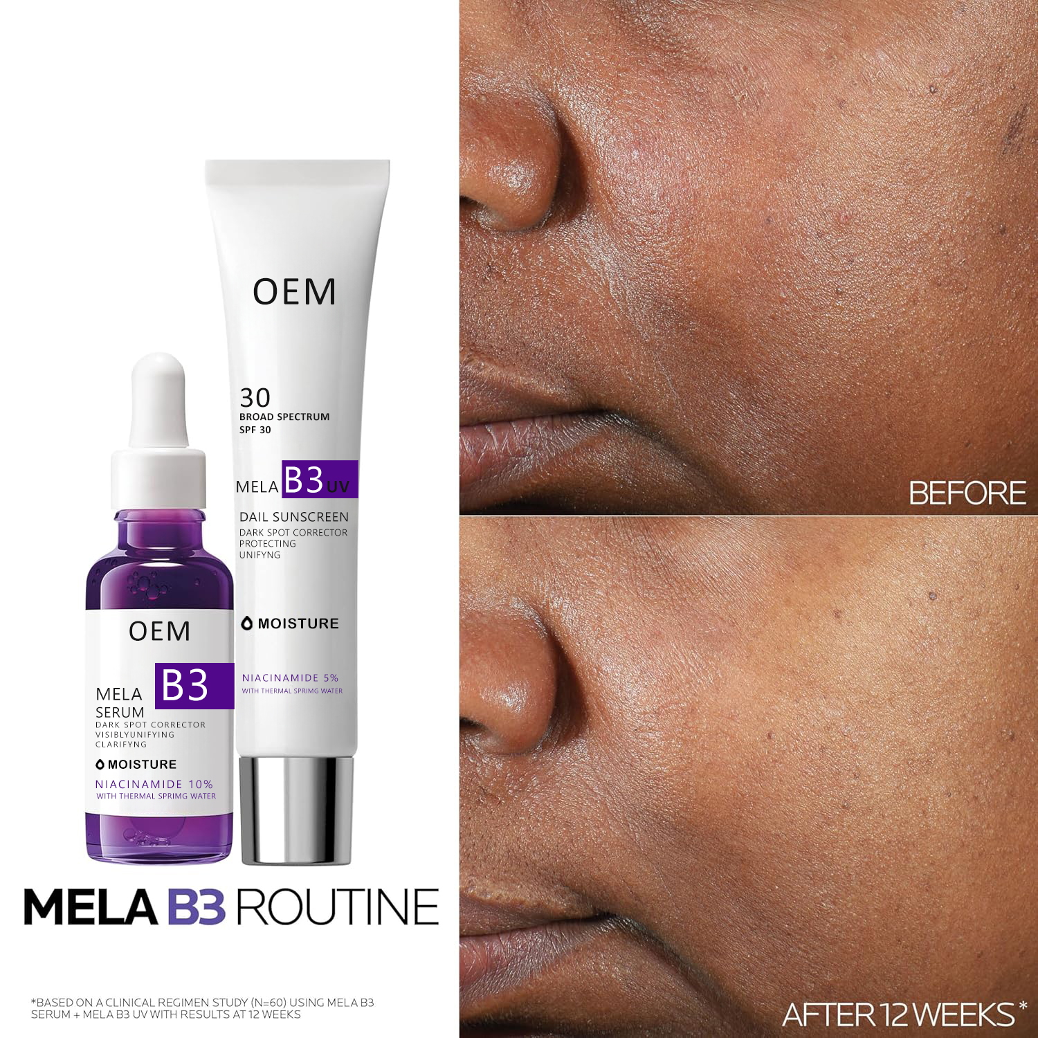 Dark Spot Correcting Serum