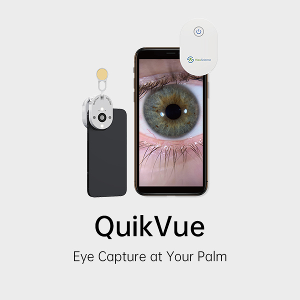 Eye Imaging Adaptor QuikVue Plus