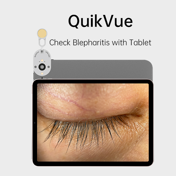Eye Imaging Adaptor QuikVue Plus VPA-200